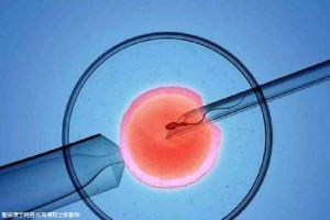 供卵代生咨询哪家靠谱
